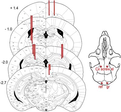 Characterization of Epileptic Spiking Associated With Brain Amyloidosis in APP/PS1 Mice